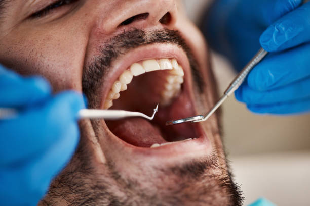 Best Urgent Dental Care for Toothaches in Lake Delton, WI